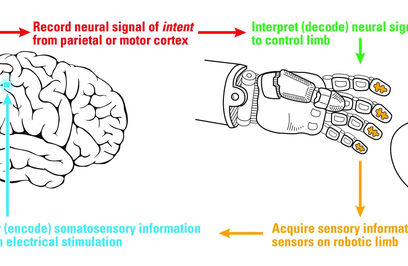 USC Researcher Leads First Team to Use Electrical Brain Stimulation to Produce Functional Sense of Touch 